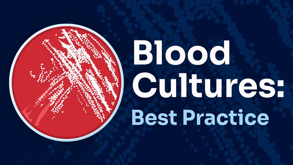 Cover image for: Blood Cultures: Best-Practice