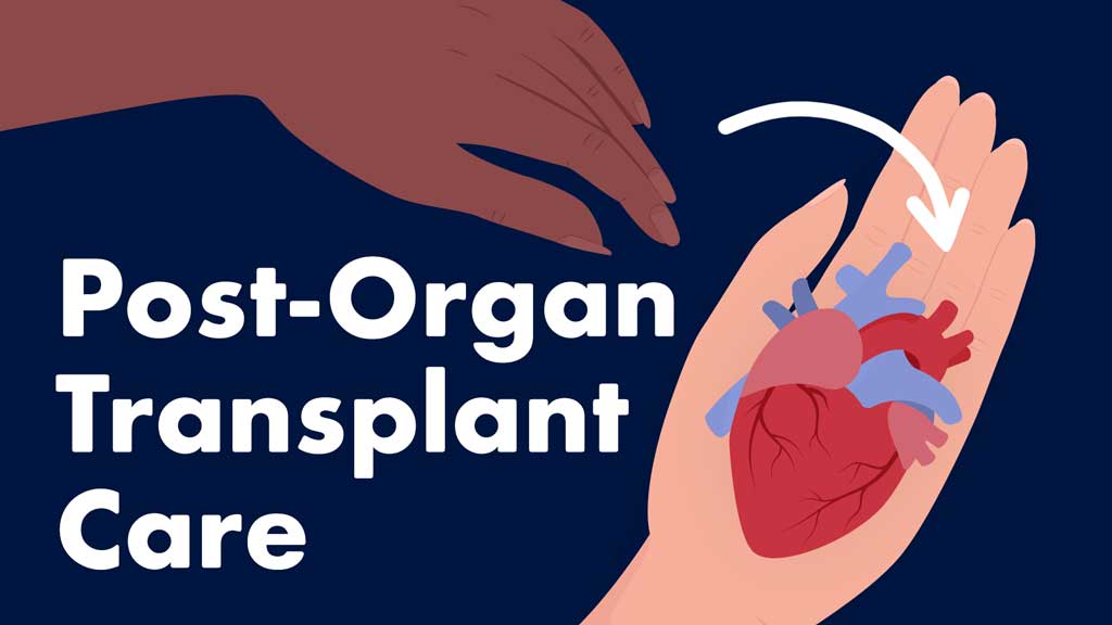 Cover image for: Post-Organ Transplant Care