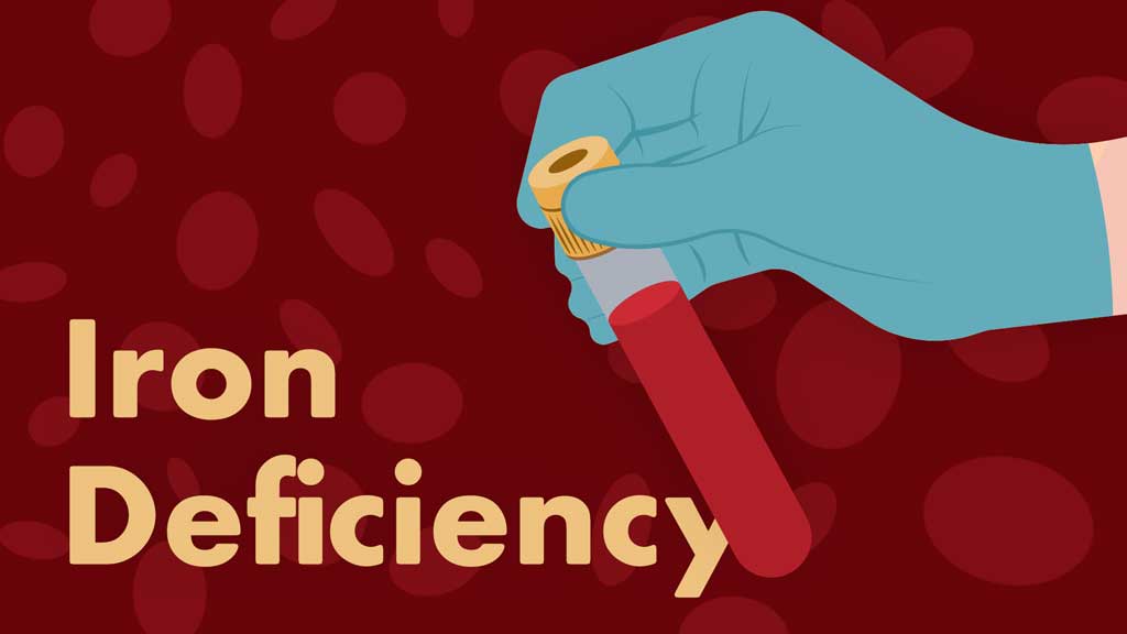 Cover image for: Iron Deficiency