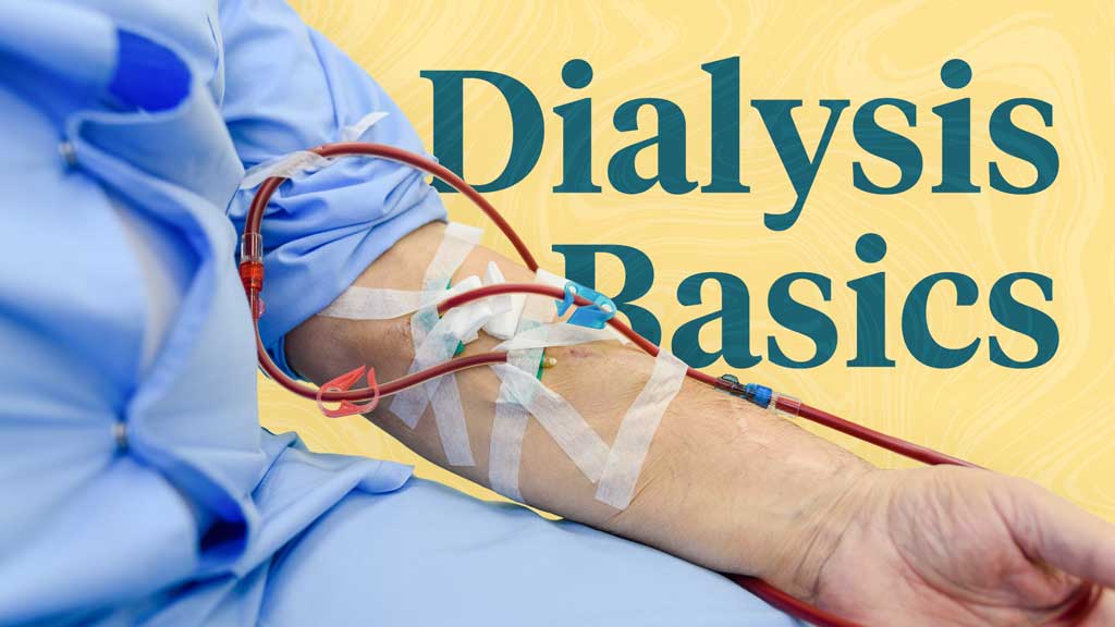 Cover image for: Dialysis Basics