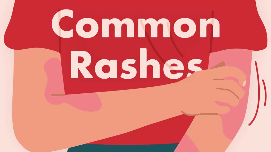 Cover image for: Common Rashes: An Overview