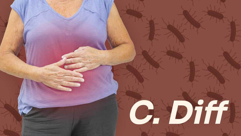 Image for Clostridioides difficile (C. diff) Infection