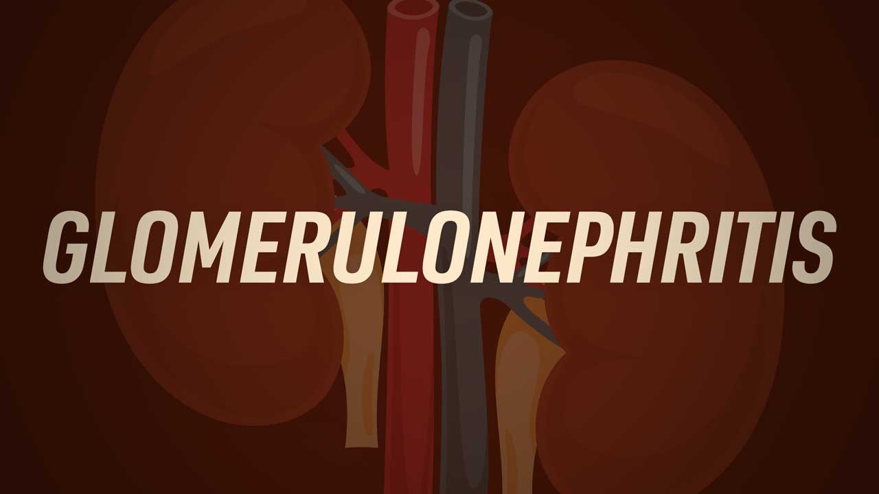 Cover image for: Glomerulonephritis