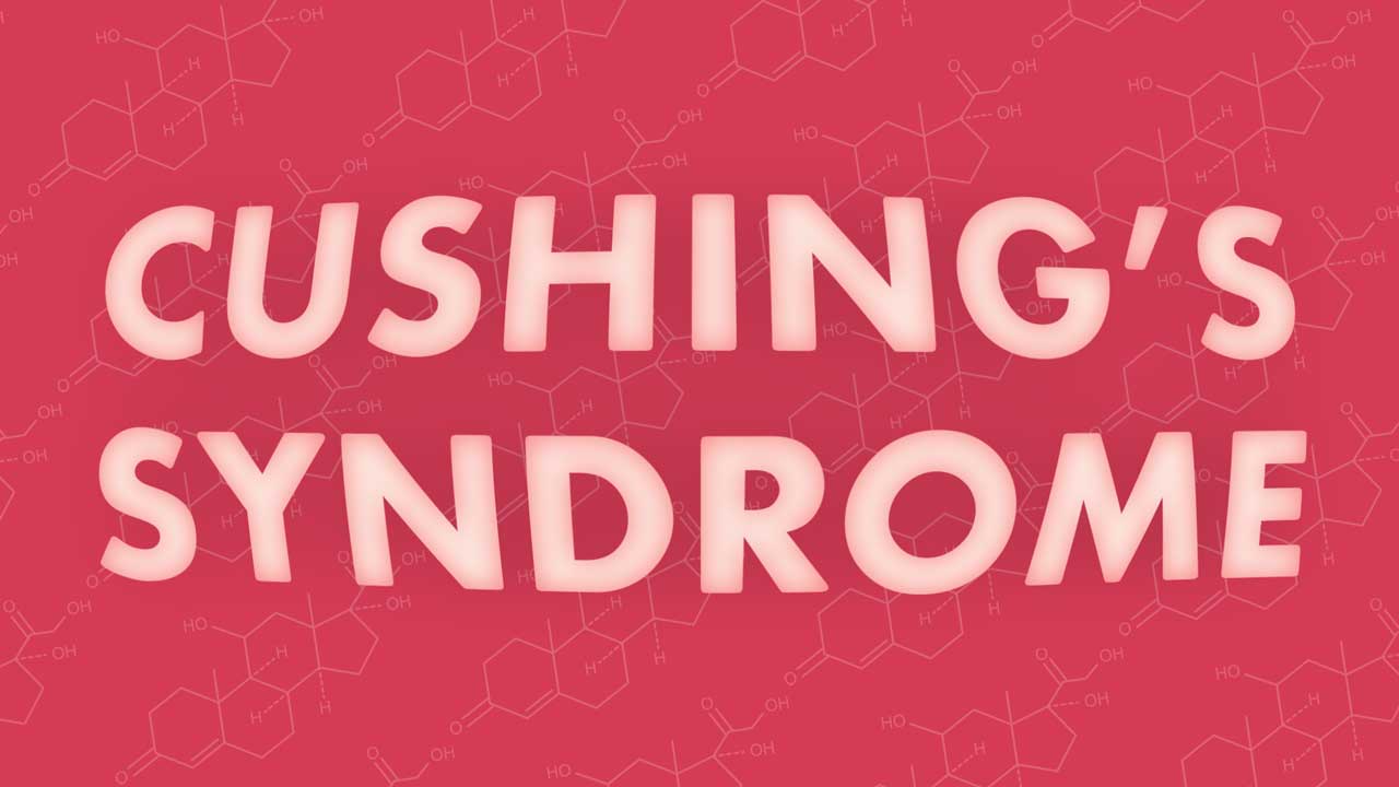 Cover image for: Cushing’s Syndrome