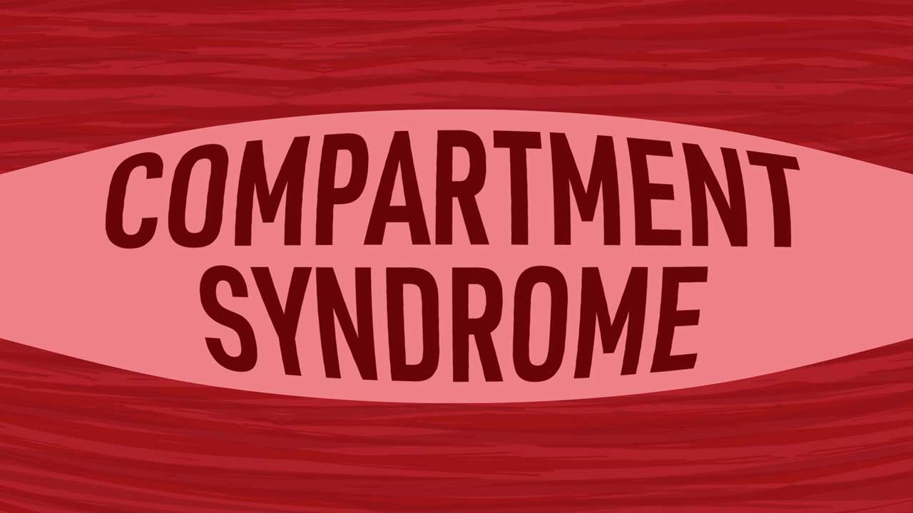 Cover image for: Compartment Syndrome