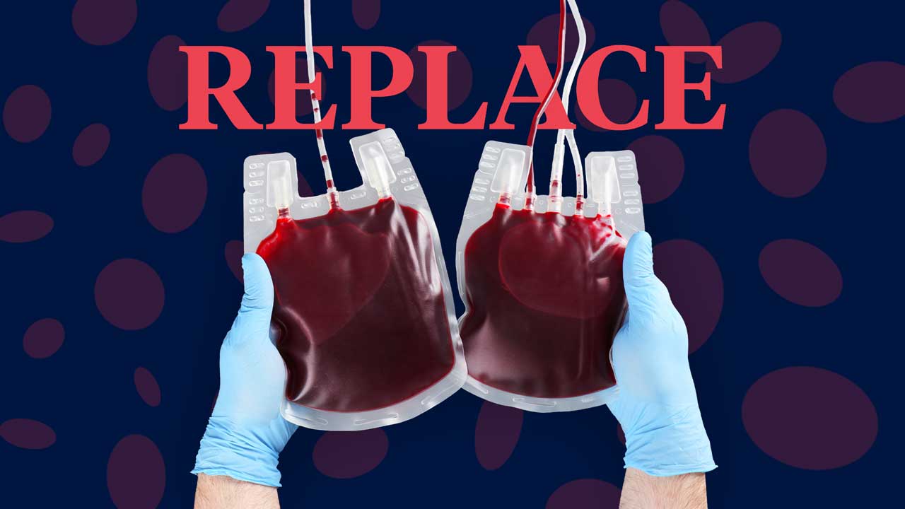 Cover image for: REPLACE: Seven Steps to Remember During A Massive Blood Transfusion
