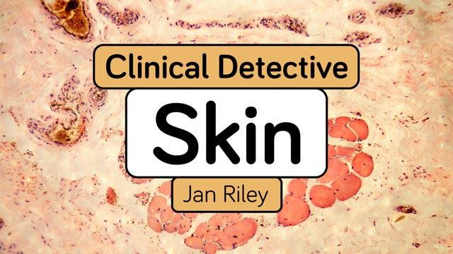 Image for Clinical Detective: Skin