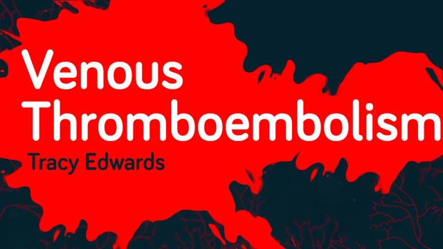 Image for Venous Thromboembolism
