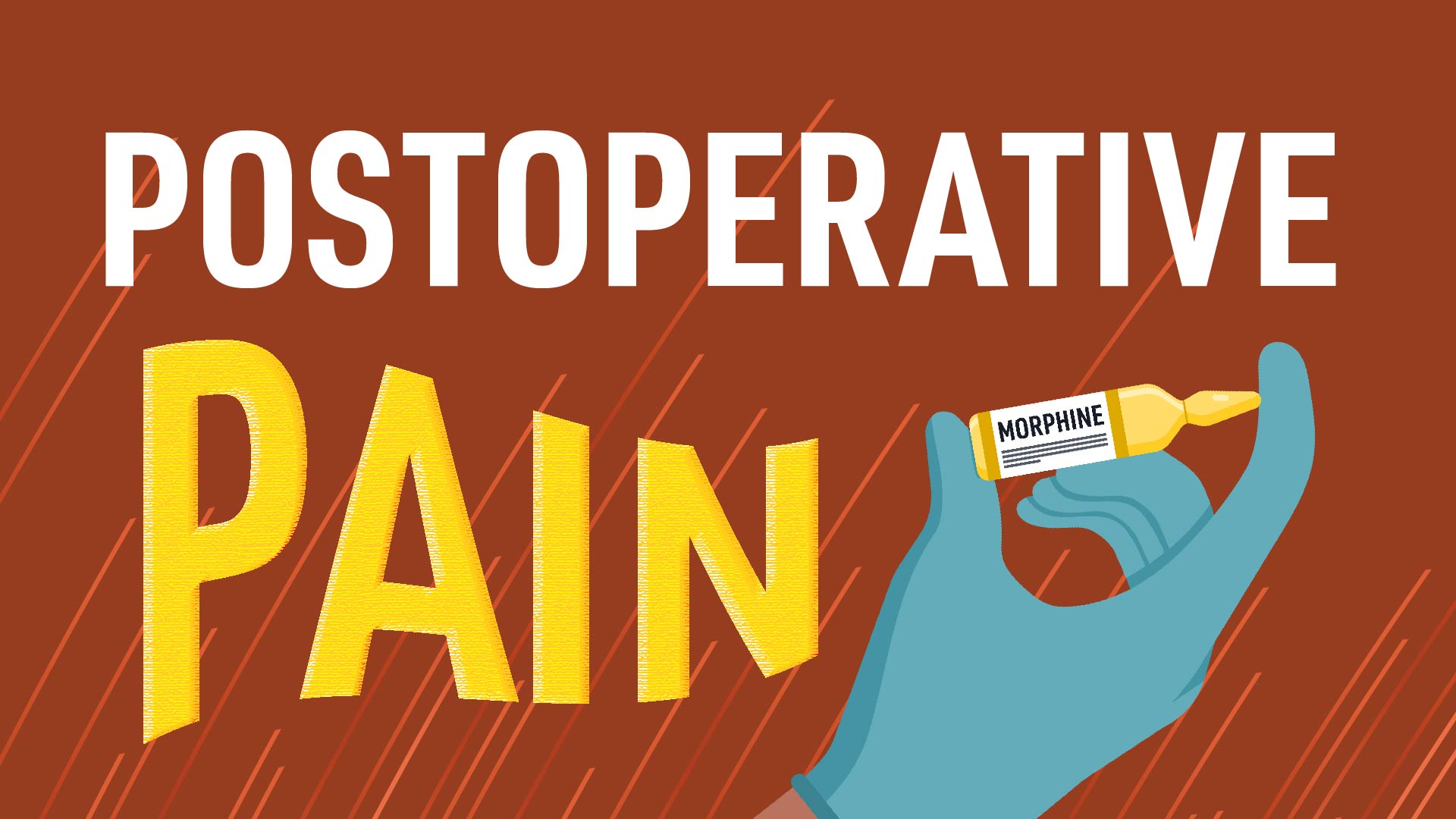 Cover image for: Postoperative Pain
