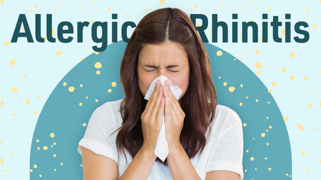 Image for Allergic Rhinitis