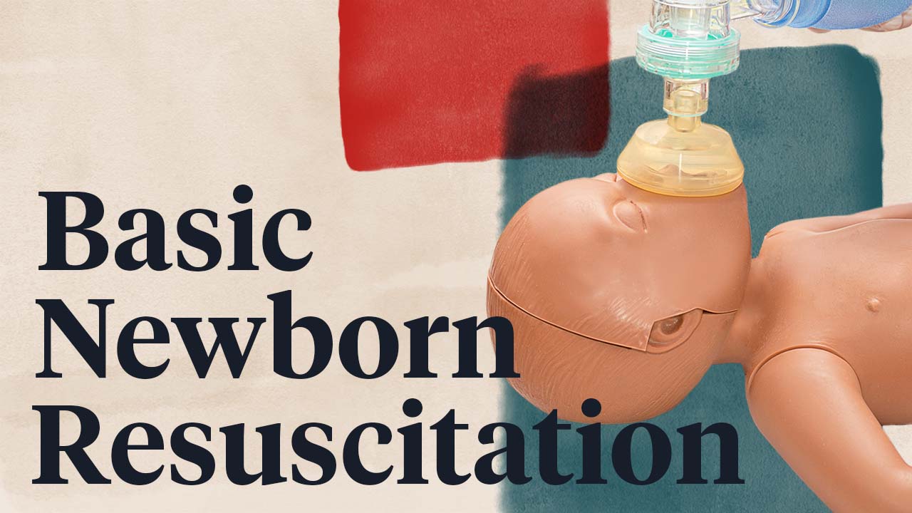 Cover image for: Newborn Resuscitation