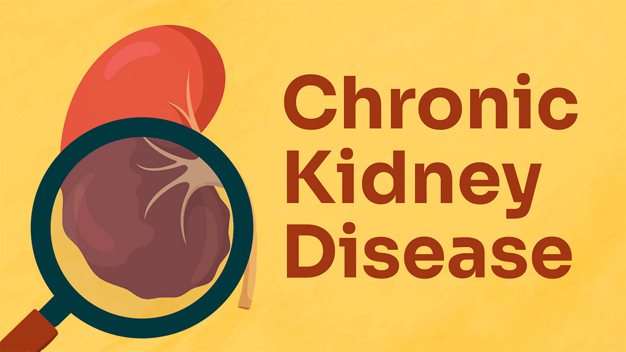 Cover image for: Chronic Kidney Disease (CKD)