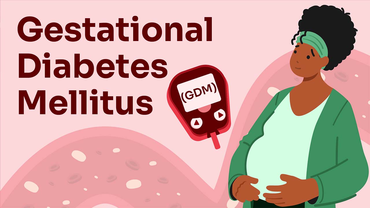 Image for Gestational Diabetes Mellitus