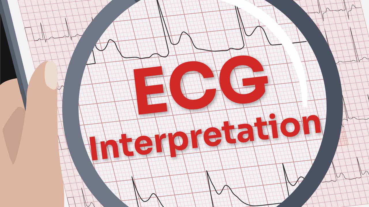 Image for Basic ECG Interpretation