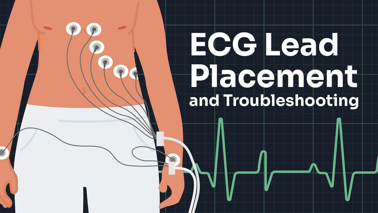 Image for ECG Lead Placement and Troubleshooting