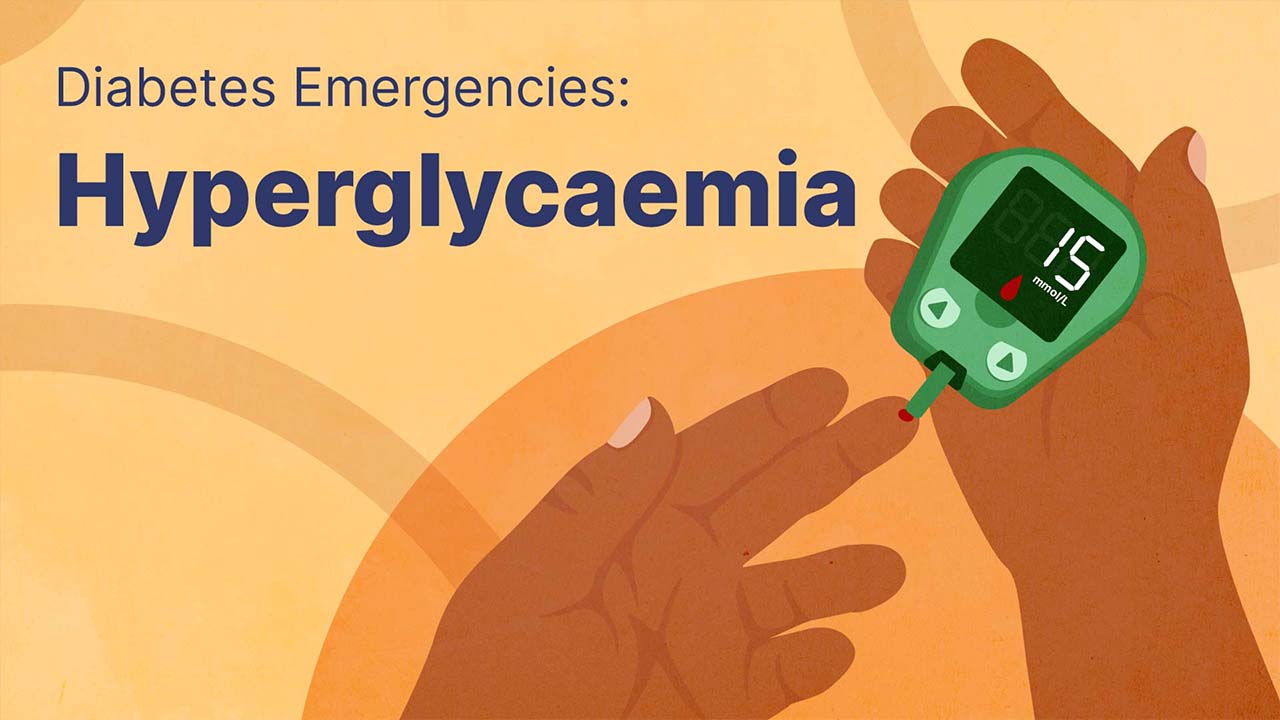 Cover image for: Diabetes Emergencies: Hyperglycaemia