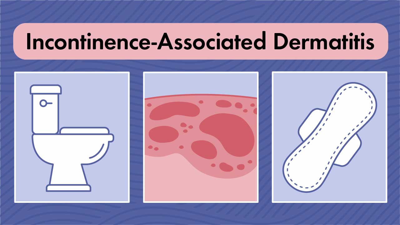 Image for Incontinence-Associated Dermatitis (IAD)