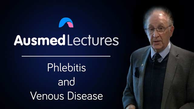 Cover image for: Phlebitis and Venous Disease