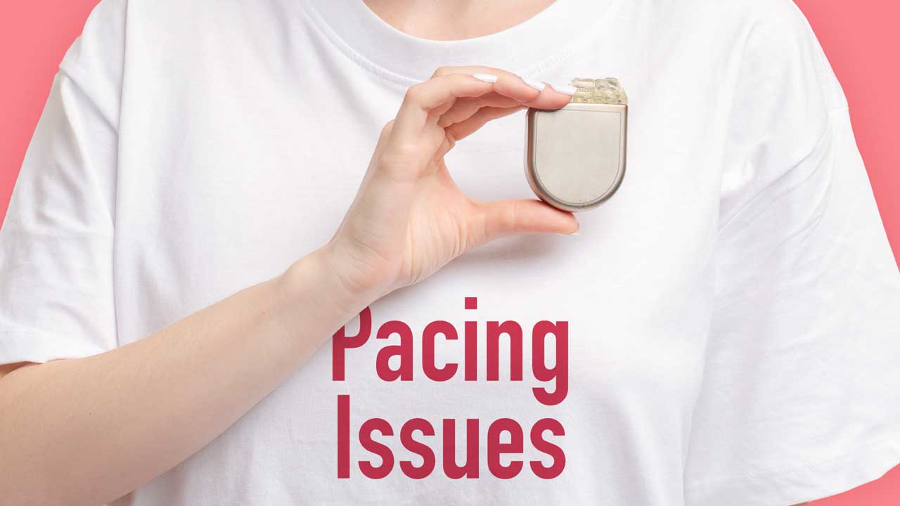 Cover image for: Understanding Pacing Issues