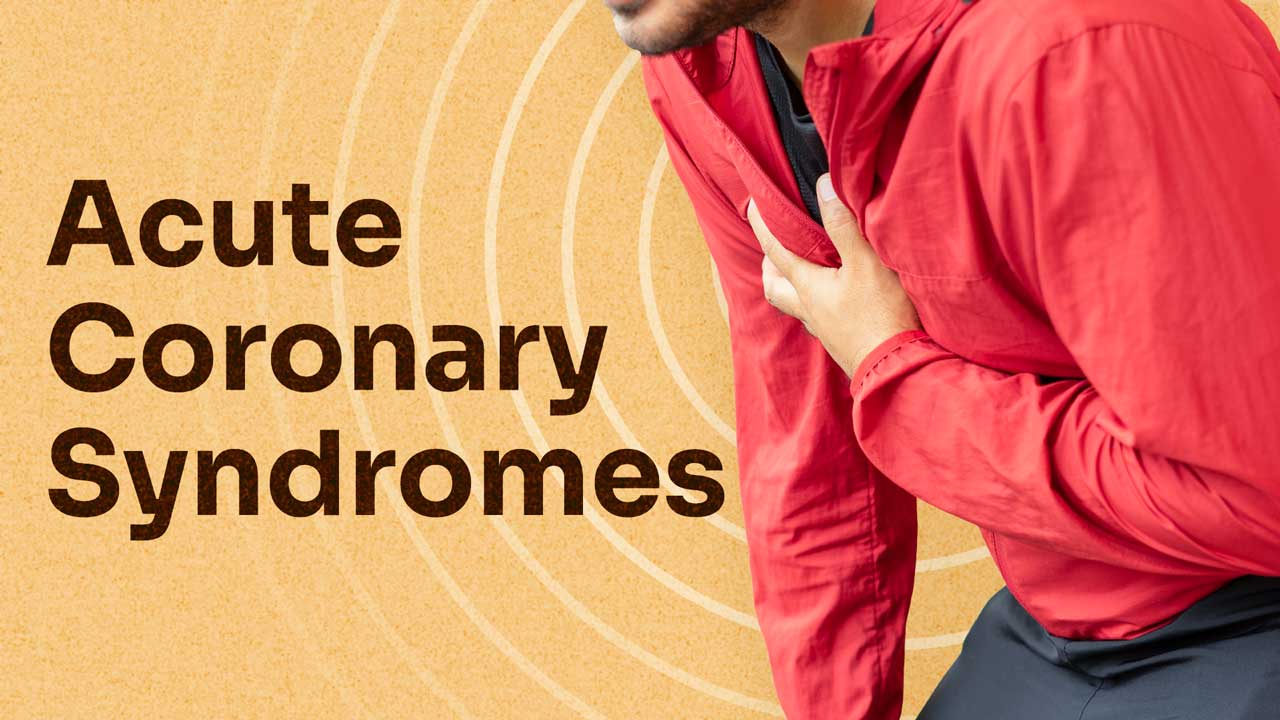 Cover image for: Identifying Acute Coronary Syndromes