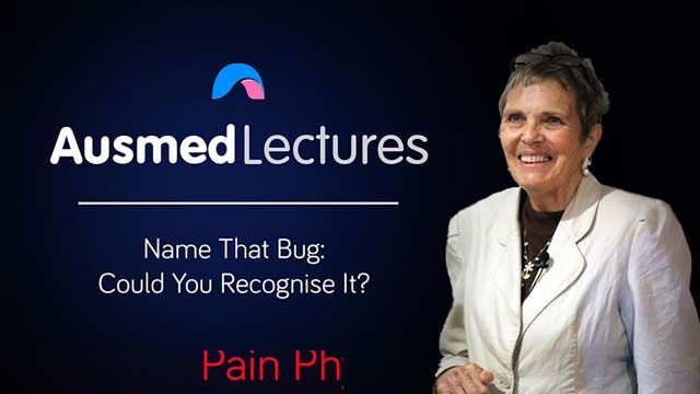 Cover image for lecture: Name That Bug: Could You Recognise It?