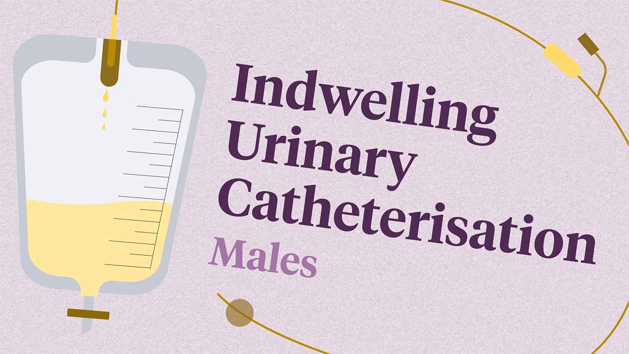 Cover image for: Indwelling Urinary Catheterisation (Males)